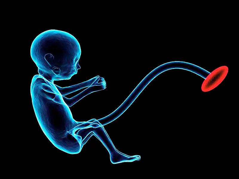 Внутриутробные причины развития синдрома Туретта Внутриутробный плод